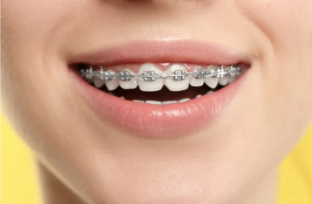 Woman with Braces