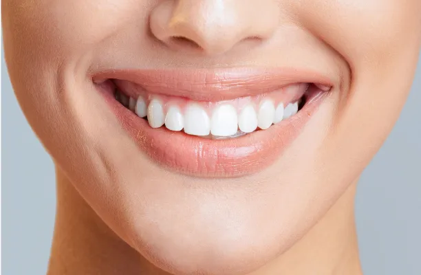 Woman smiling with perfect white teeth